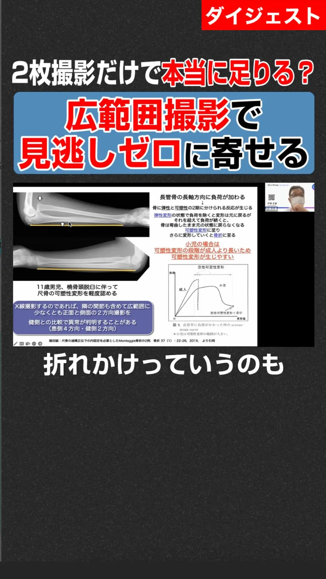 小児四肢骨折治療の実際 | 医書.jp 裁断済み 未裁断！ YouTube 【裁断